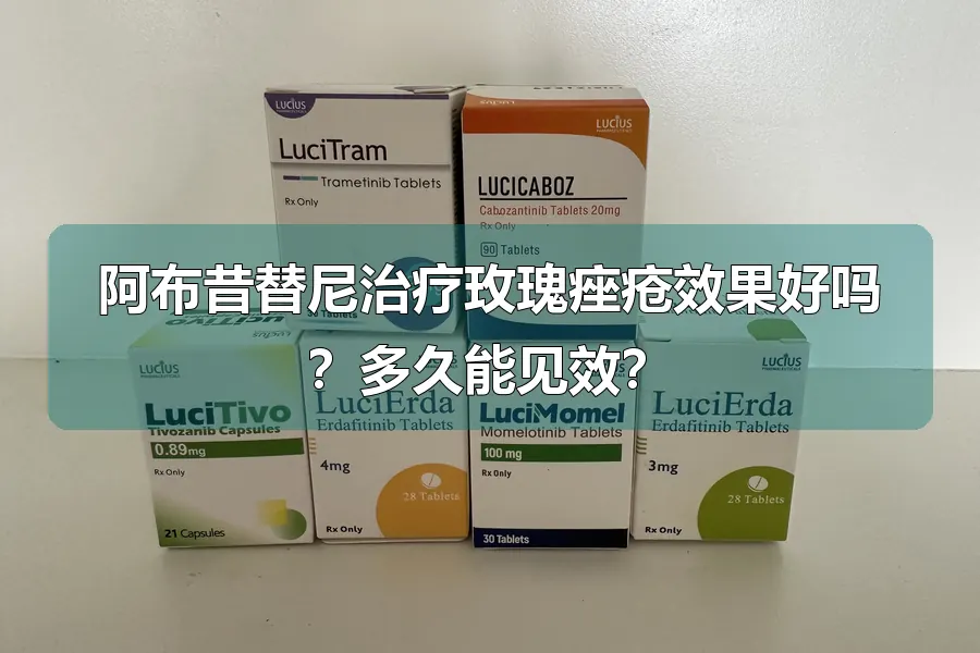 阿布昔替尼治疗玫瑰痤疮效果好吗?多久能见效?